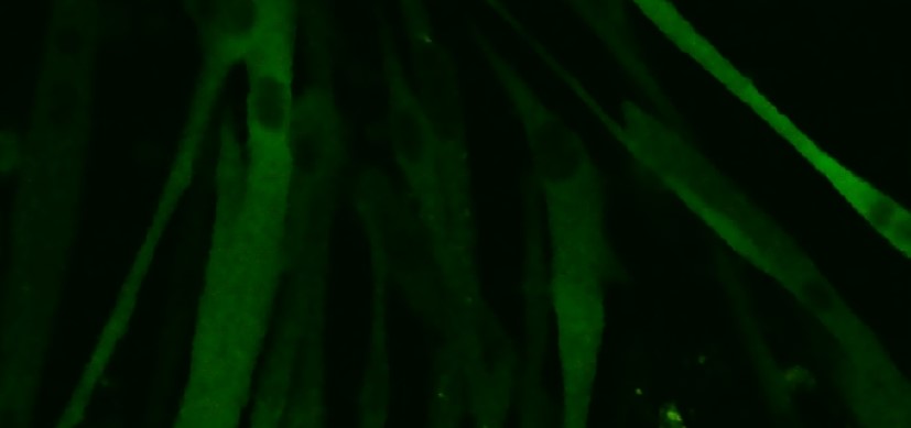 Myofibers-and-Macrophages-2.jpg Surprising Insight May Put a Charge into Faster Muscle Injury Repair