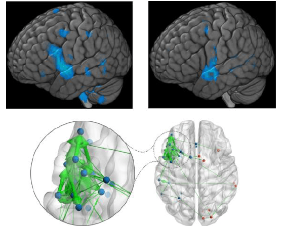 Language development and localization revealed by MEG functional connectivity analysis.