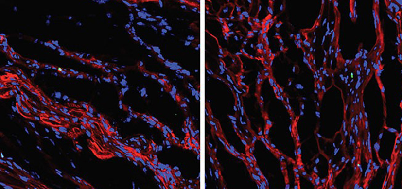 Tbx20-heart-8x4-1.jpg Teaching an Old Dogma New Tricks