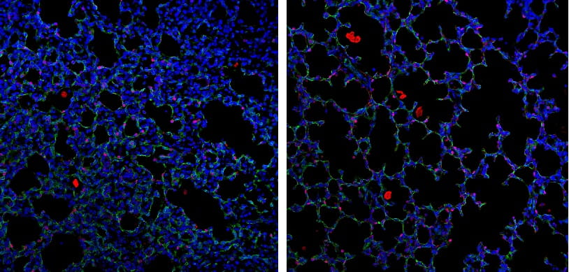 New Research on Cell Regeneration Shows Promise for Treating Lung