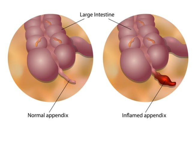 appendix