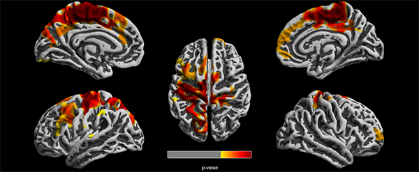 Brain images of 12-year-old children.