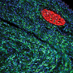A photo of a sciatic nerve tumor from a Lats1/2-def mouse.