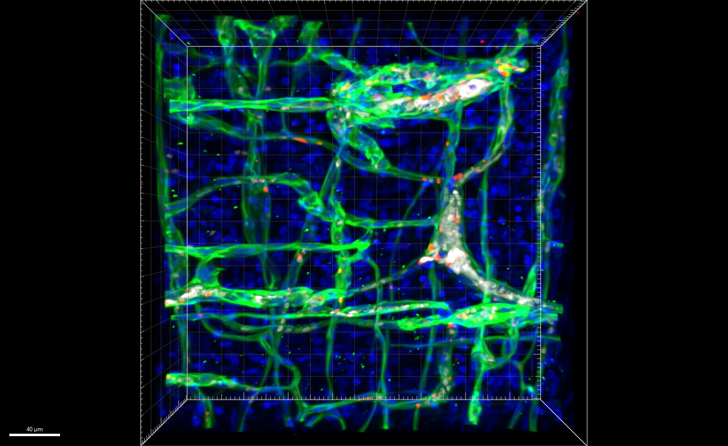 New Mouse Model Enables Discovery of Potential Treatment for Rare Vascular Tumors—and Beyond This 3D image reconstruction shows the distorted vascular structure (green) of a mouse expressing mutant GNAQ.