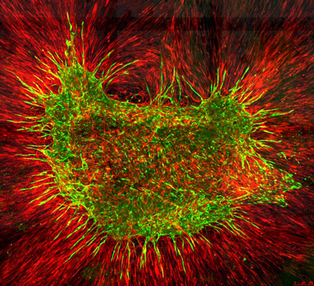 Figure 4. Human endothelial network model in vitro.