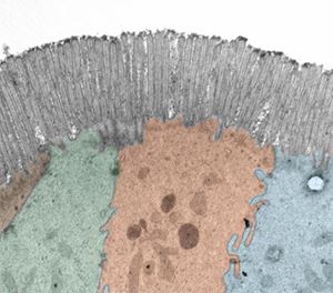 Gastro-coverart-submission_GASTRO-D-17-01442R1_flat