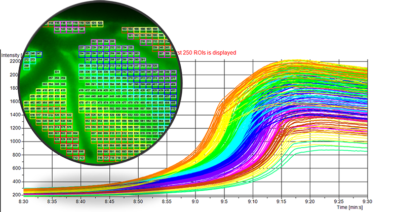 An image showing quantification of spatiotemporal progression of spreading depolarization across the brain cortex at 20x magnification.