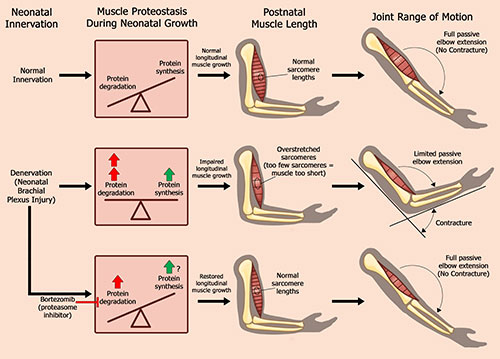 Figure 3: Myoblasts expressing green fluorescent protein injected into denervated muscle fuse with myofibers and restore their growth following NBPI.