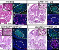 The role of primary cilia during glossal development image.