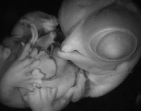 Using the avian model talpid2 to study human craniofacial ciliopathies image.