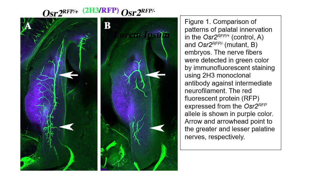 Palate Development and Palatal Innervation.