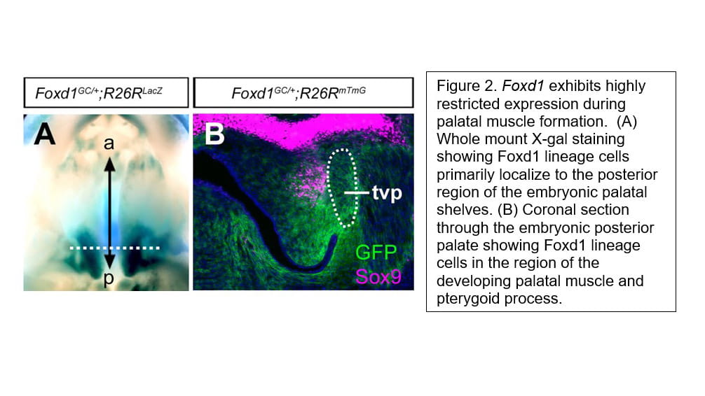 Regulation of Palatal Muscle Development.