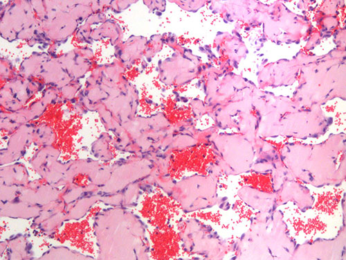 Arteriograms of the lungs.