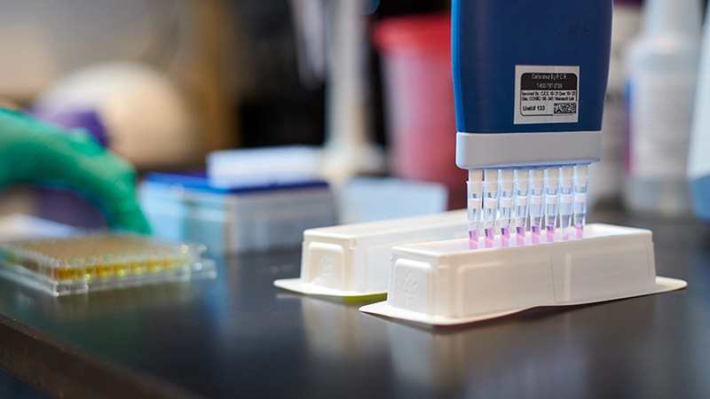 A photo of a multi-channel pipette.