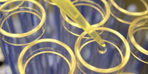 The Diagnostic Immunology Laboratory at Cincinnati Children's.